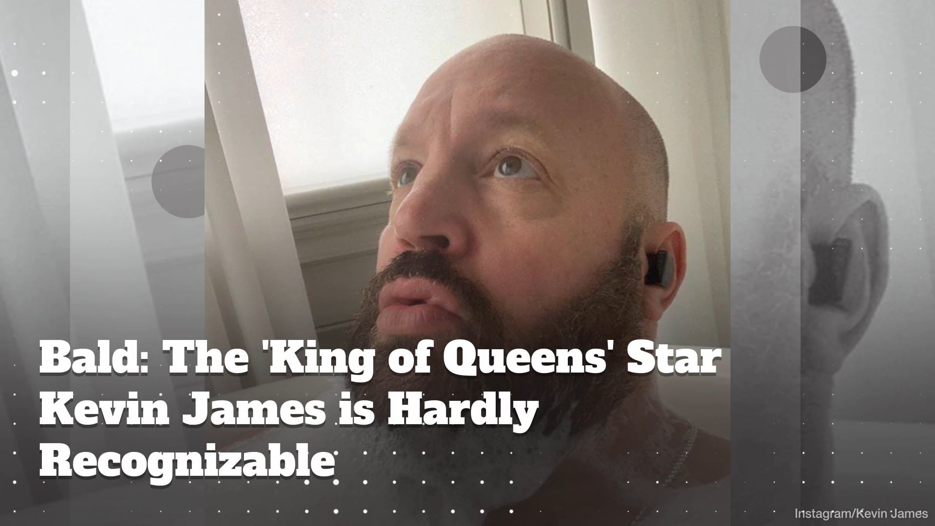 Bald: 'King of Queens' Star Kevin James is Hardly Recognizable! - video  Dailymotion