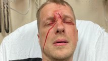 Oliver Pocher im Krankenhaus nach Verletzung mit Gewehr