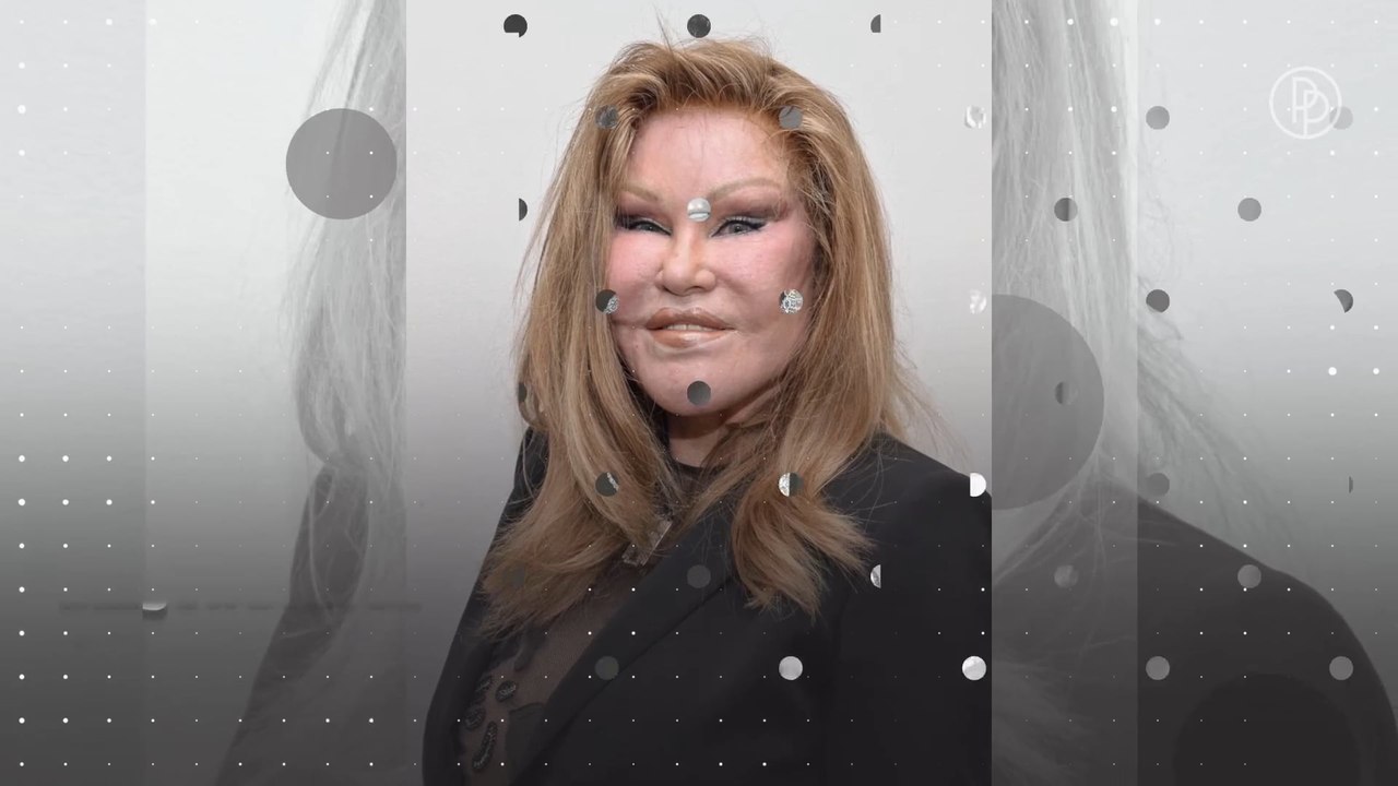 Katzenfrau Jocelyn Wildenstein: Ihre tragische Lebensgeschichte