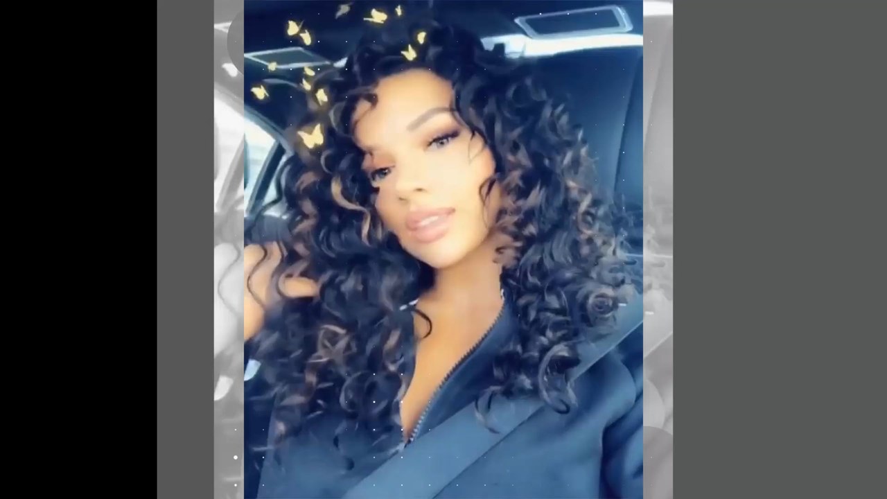 Shirin David spricht über Horror bei Nasen-OP