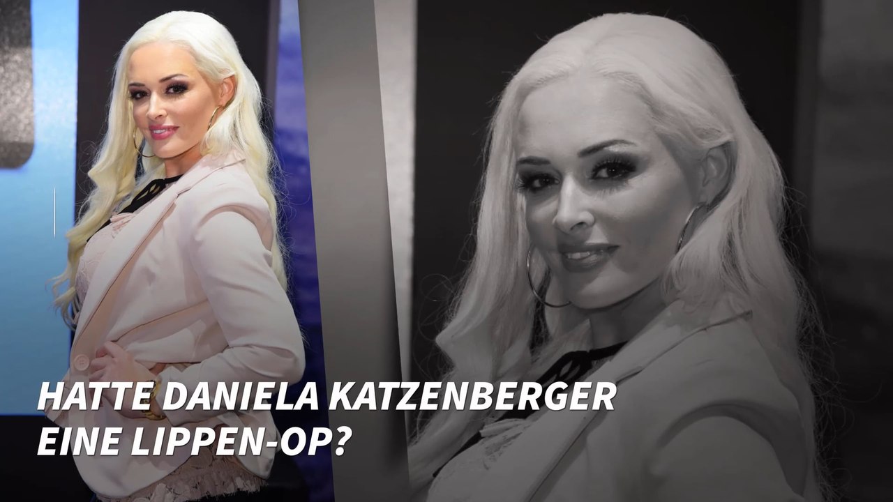 Daniela Katzenberger mit Monster-Lippen