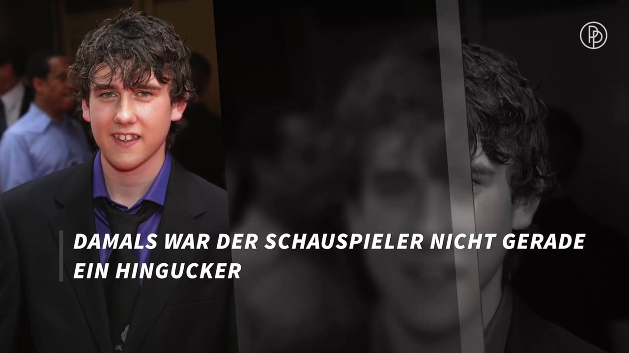 Stars, die sich in Schönheiten verwandelt haben