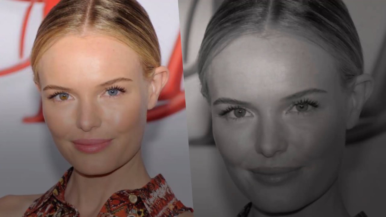 Stars, die zwei verschiedene Augenfarben haben