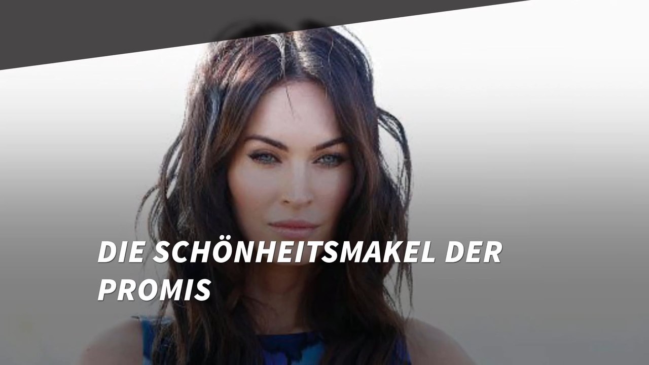 Die Schönheitsmakel der Stars - auch sie sind nicht perfekt