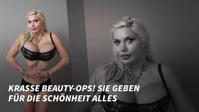 Krasse Beauty-OPs! Sie geben für die Schönheit alles