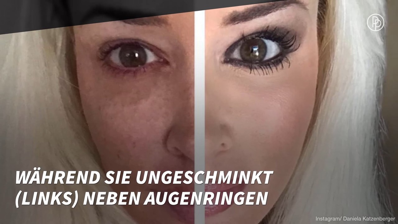 Daniela Katzenberger: Krasses Vorher-Nachher-Bild