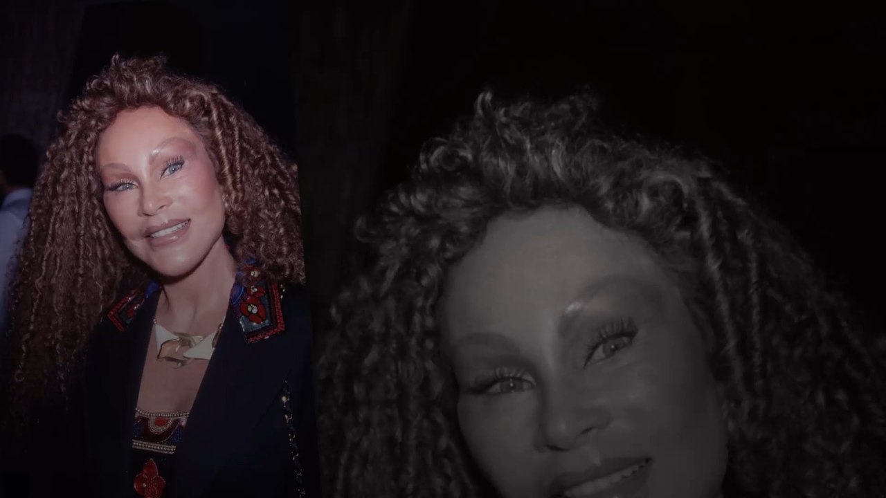 Stars vor den Beauty-OPs: Erkennt ihr, wer das ist? - Teil 2