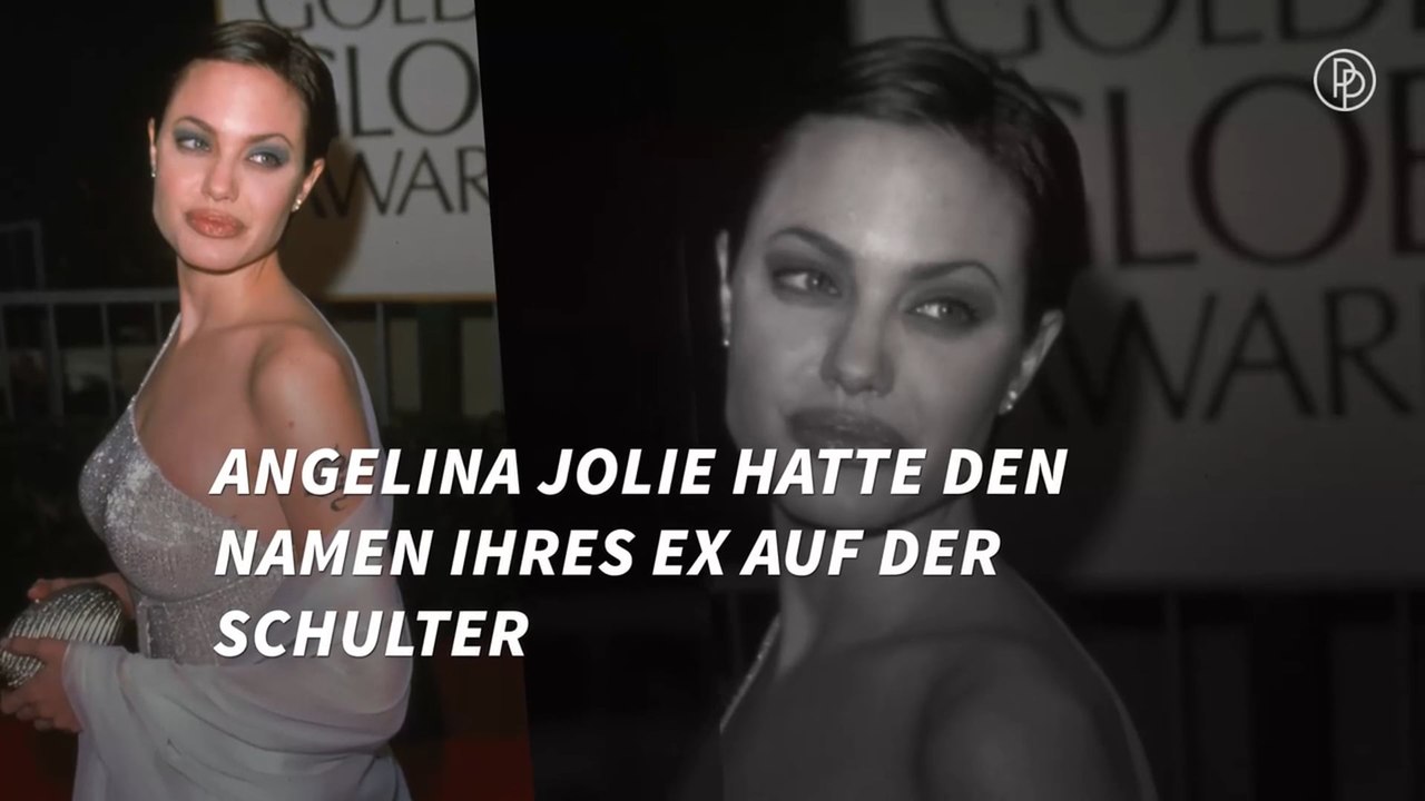 Diese Stars ließen ihre Tattoos entfernen