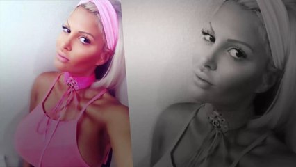 Sophia Wollersheim nach Rippenentfernung: Klare Ansage an alle Hater