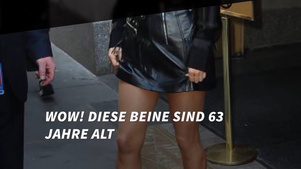 Diese Beine sind 63 Jahre alt