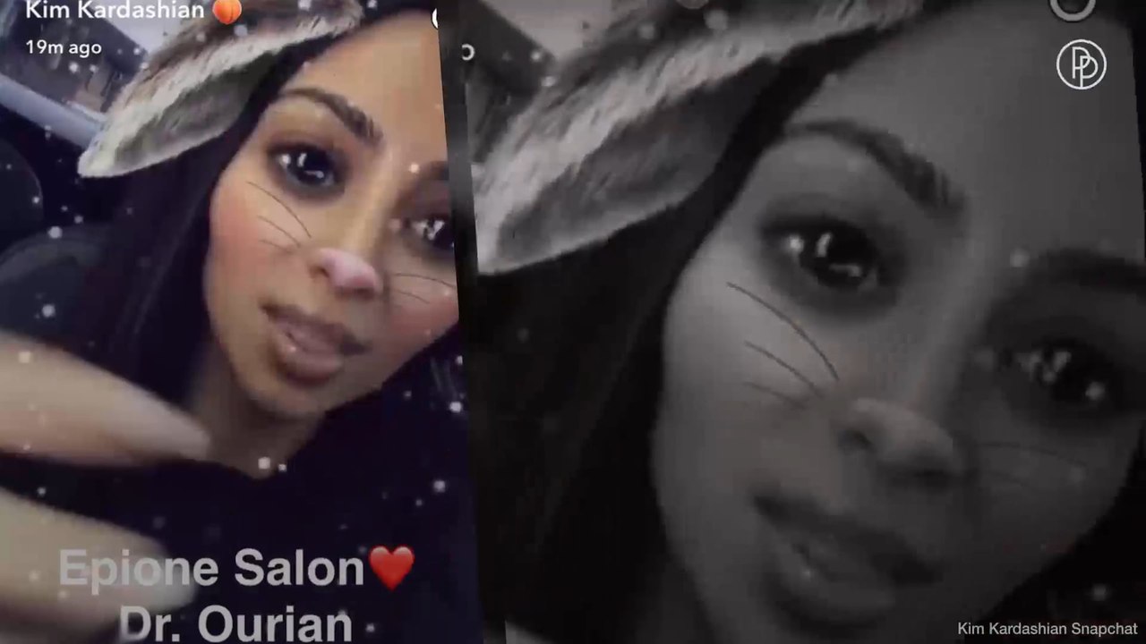 Kim Kardashian freut sich über das Entfernen ihrer Dehungsstreifen