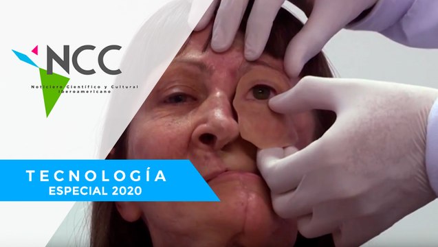 In­ves­ti­ga­do­res crean pró­te­sis fa­cia­les más eco­nó­mi­cas y en me­nos tiem­po gra­cias a la im­pre­sión 3D