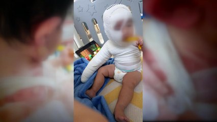 "자가격리 아이, 화상치료 거부당해" 확진자 아빠 글에 도움 손길 / YTN