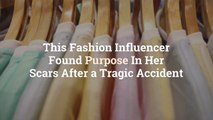 This Fashion Influencer Found Purpose In Her Scars After a Tragic Accident