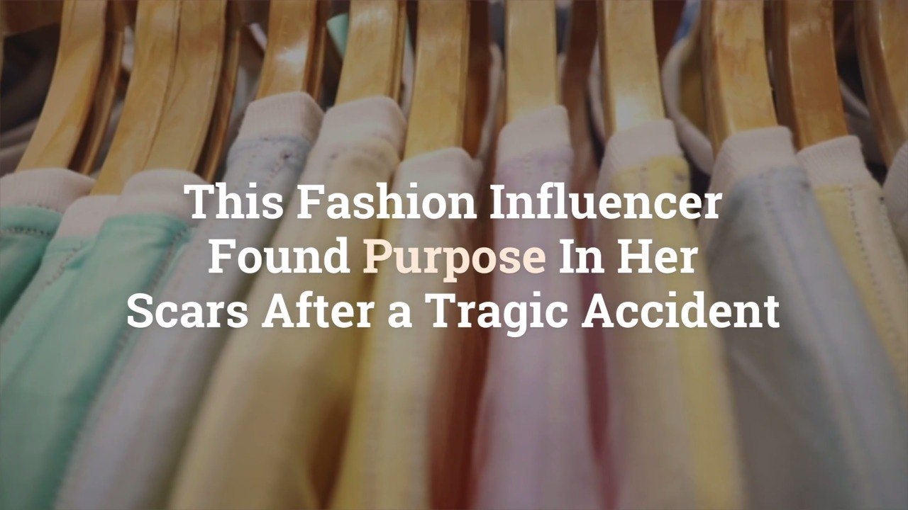 This Fashion Influencer Found Purpose In Her Scars After a Tragic Accident