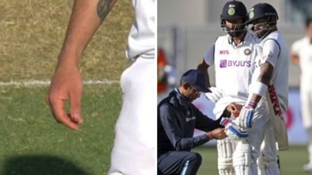 Ind vs Aus 2020,1st Test : Kohli's Right-Hand Thumb Gets Injured Off Mitchell Starc's Bouncer