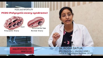 What is PCOS? PCOS क्या है? पीसीओएस और बांझपन