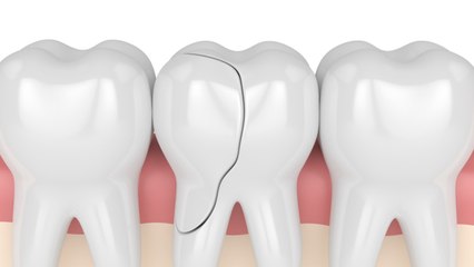 Dentist's 'Crowning Achievement' May Land Him 20 Years In The Slammer