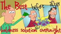 The Best Baldness Solution Overnight [Welcome back, my sexy hair] | Cartoon Animation | 1min cartoon