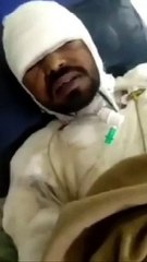 Video Statement of one of the two burned worker from Jainam Ferro Alloys, Birgaon