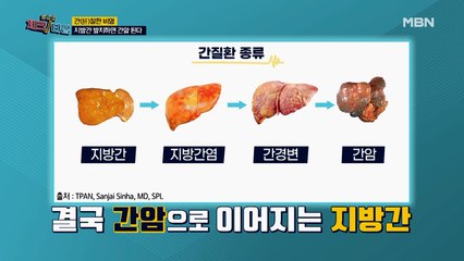 간(肝)절한 비명! 지방간 방치하면 간암 된다!
