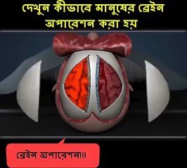 Dekhe brain operation kaise hota h