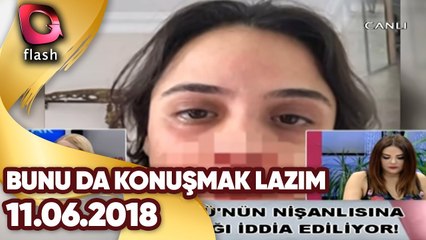 Bunu Da Konuşmak Lazım | 11 06 2018