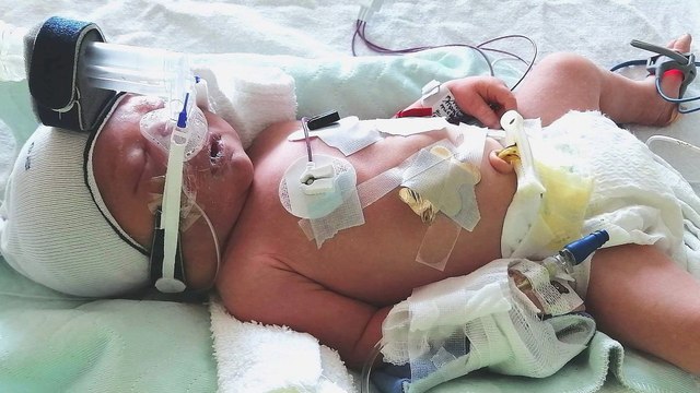 Une campagne de socio-financement pour aider une famille de Rivière-du-Loup