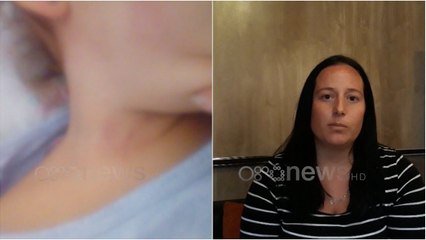 Ora News - Dhunimi i fëmijës në kopësht, Nëna: Shenjat i kishin mbuluar me pudër