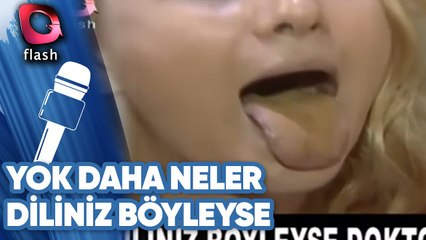 DİLİNİZ BÖYLEYSE DOKTORA GİDİN! | YOK DAHA NELER