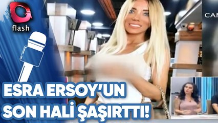 CİCİŞ ESRA ERSOY'UN SON HALİ ŞAŞIRTTI!
