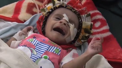 الأوضاع الإنسانية والمعيشية باليمن في تدهور مستمر