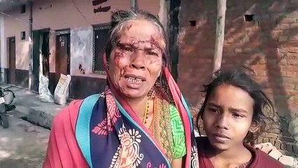 अपनी ही जमीन पर गाय बांधने को लेकर विवाद में तीन महिलाओं में मारपीट, एक महिला घायल