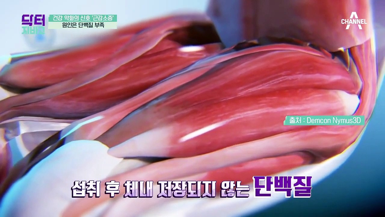 건강 악화의 신호 '근감소증', 원인은 단백질 부족