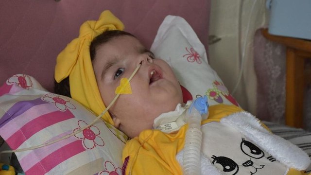 SMA hastası 17 aylık Yaren, tedavi için destek bekliyor