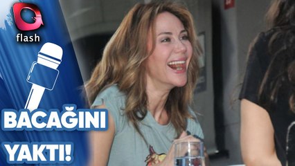 Demet Şener Bacağını Yaktı!