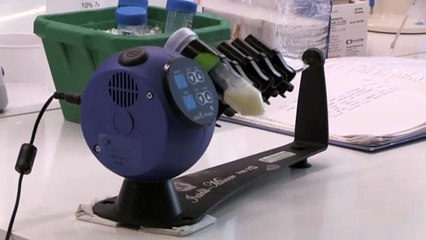 Ελλάδα: 66 νεκροί-467 διασωληνωμένοι και 476 νέα κρούσματα