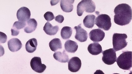 Super Gonorrhea, Real And Gonna Get Worse