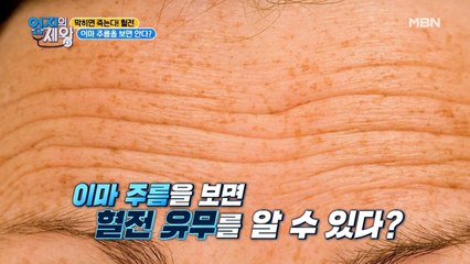 갑작스럽게 생긴 이마 주름…! 심혈관 질환의 증상이다?