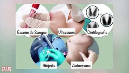 caras saude e voce 007