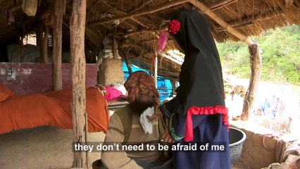 They Call Me 'The Man With No Face' - BORN DIFFERENT