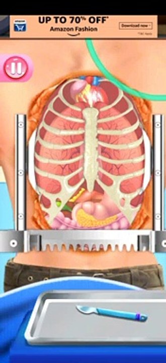 heard surgery on the hospital game play views Record_2021-01-04-12-38-14_c089752bda691840f238080ad38a3406