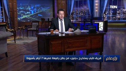 رأي عام | فريق طبي يستخرج "جنين" من بطن رضيعة عمرها 7 أيام بأسيوط.. التفاصيل 