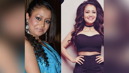 Neha Kakkar का इन चीजों से बिगड़ गया था बुरी तरह चेहरा, अब ऐसे रखती है खुद का ख्याल । Boldsky