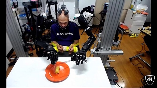Cet homme contrôle des bras robotisés avec son cerveau
