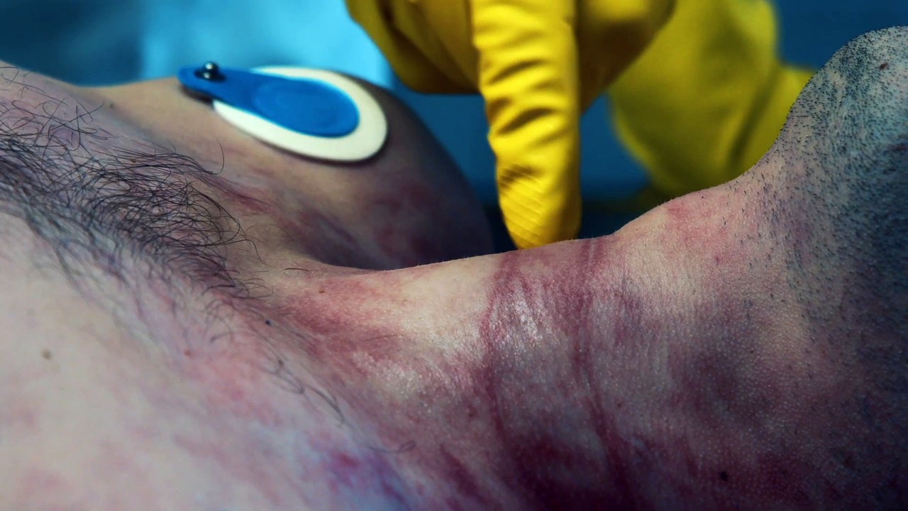 Obduktion – Echte Fälle mit Tsokos und Liefers - Trailer (Deutsch) HD