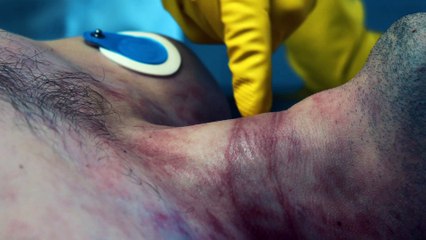 Obduktion – Echte Fälle mit Tsokos und Liefers - Trailer (Deutsch) HD