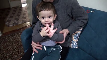 1,5 yaşındaki çocuk nadiren görülen hastalığa yakalandı! Bir eli dev gibi...
