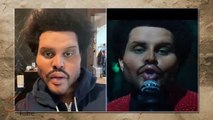 The Weeknd's plastic surgery look shocks fans