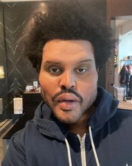 The Weeknd retire ses bandages et dévoile son nouveau visage